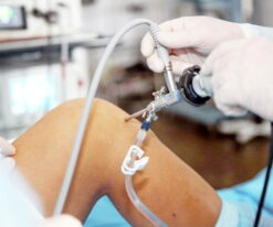 Артроскопия